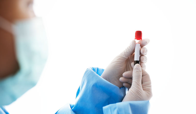 holding-blood-test-tube